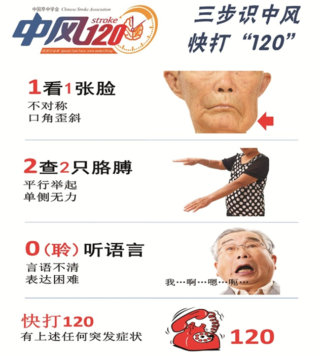 两大中心联合救治一急性心肌梗死合并急性脑梗死患者1.jpg
