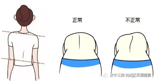 康复医学科开展“世界脊柱健康日”义诊活动5.jpg